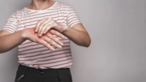 Osoba drapiąca swędzącą, zaczerwienioną skórę dłoni – przykład objawu skórnego typowego dla choroby Duhringa.